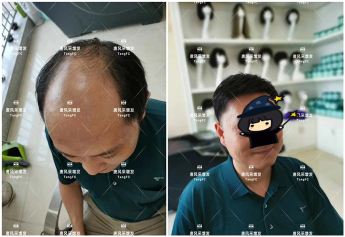 男士真發假發在哪可以定做 \