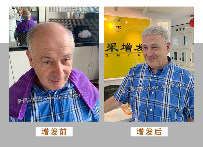 假發套怎么選 \
