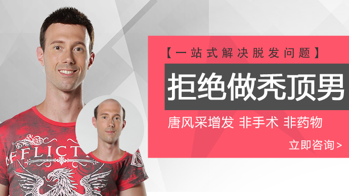頭頂假發 \