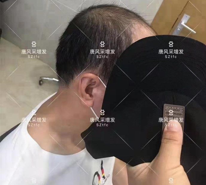 男士買假發 \