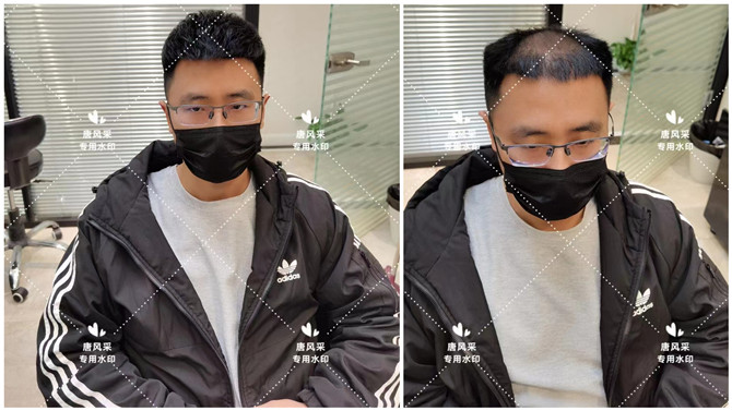 男士真人發假發 \
