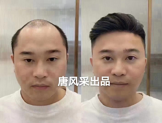 假發(fā)實體店哪家最好 \