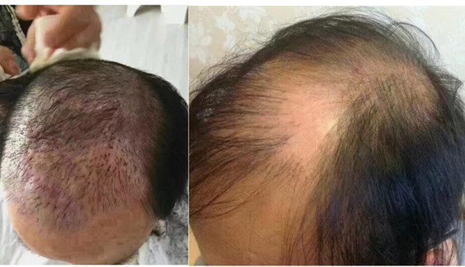 隱形增發 \