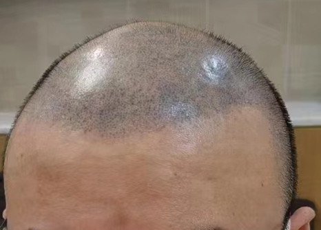 隱形增發 \