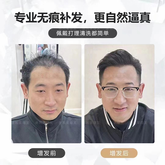隱形增發 \