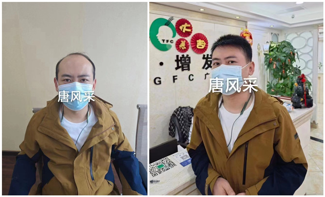 隱形增發 \