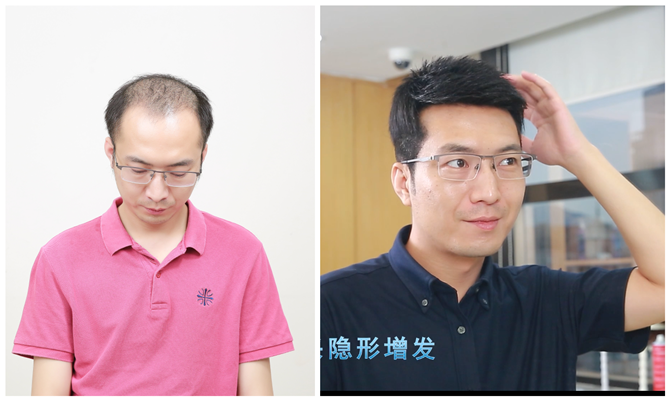 男士假發專賣店哪家好 \