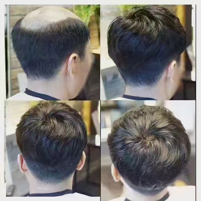 男士假發專賣店哪家好 \