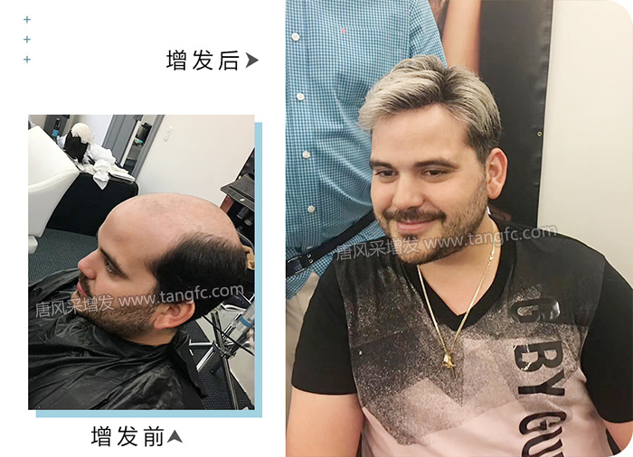 男的戴假發能看出來嗎 \