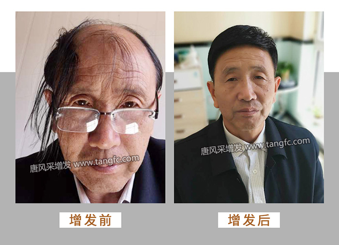 中老年人適合戴什么樣的假發 \