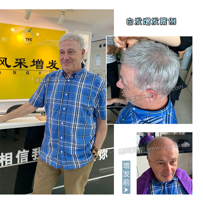 中老年人適合戴什么樣的假發 \