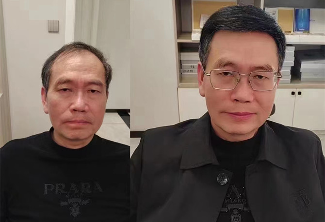 中老年人適合戴什么樣的假發 \