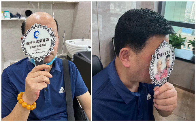 中老年人適合戴什么樣的假發 \