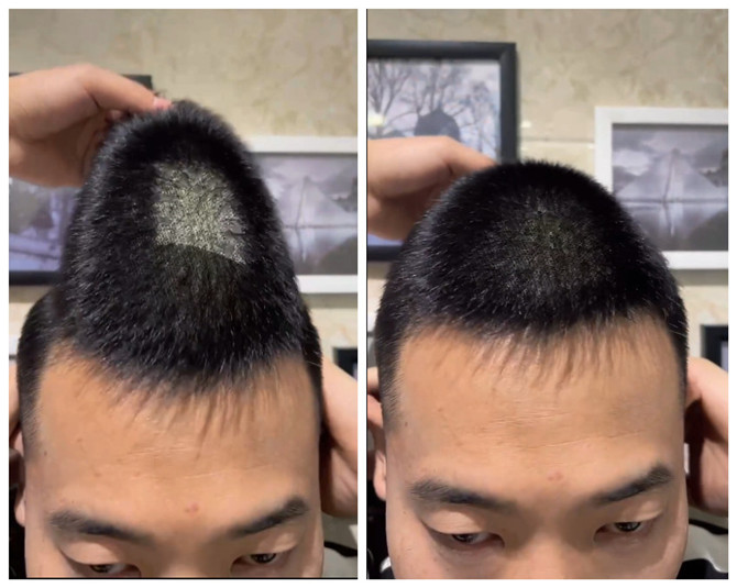 補發假發 \