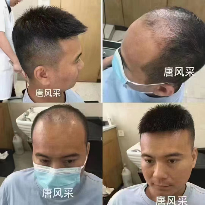 隱形補發 \