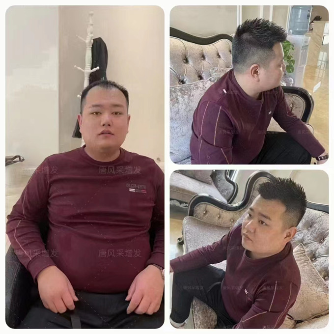 隱形補發 \