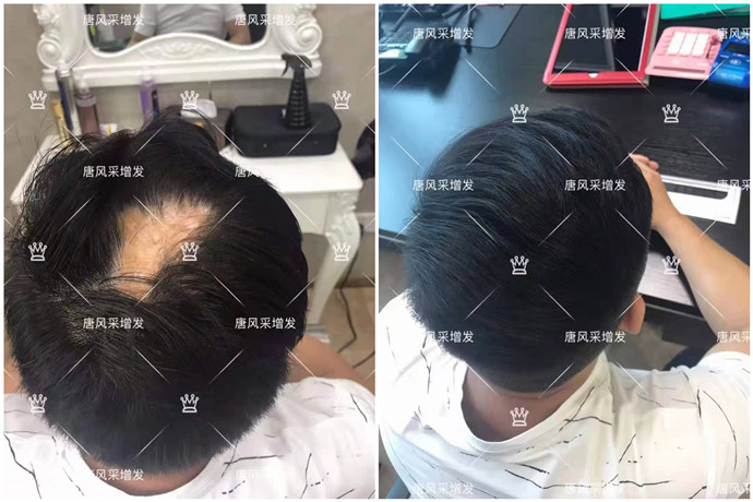 隱形補發 \