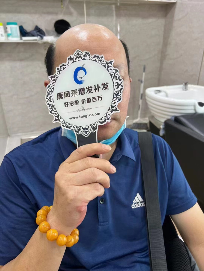 合肥假發怎么選 \