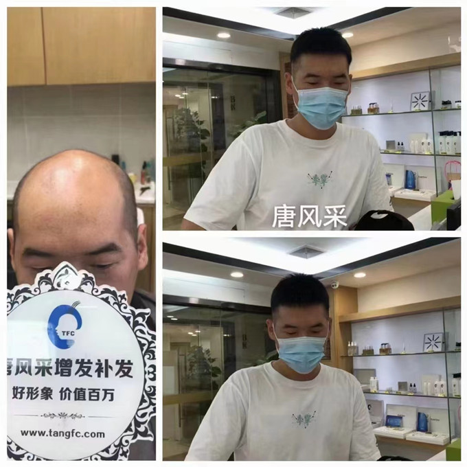 隱形增發 \