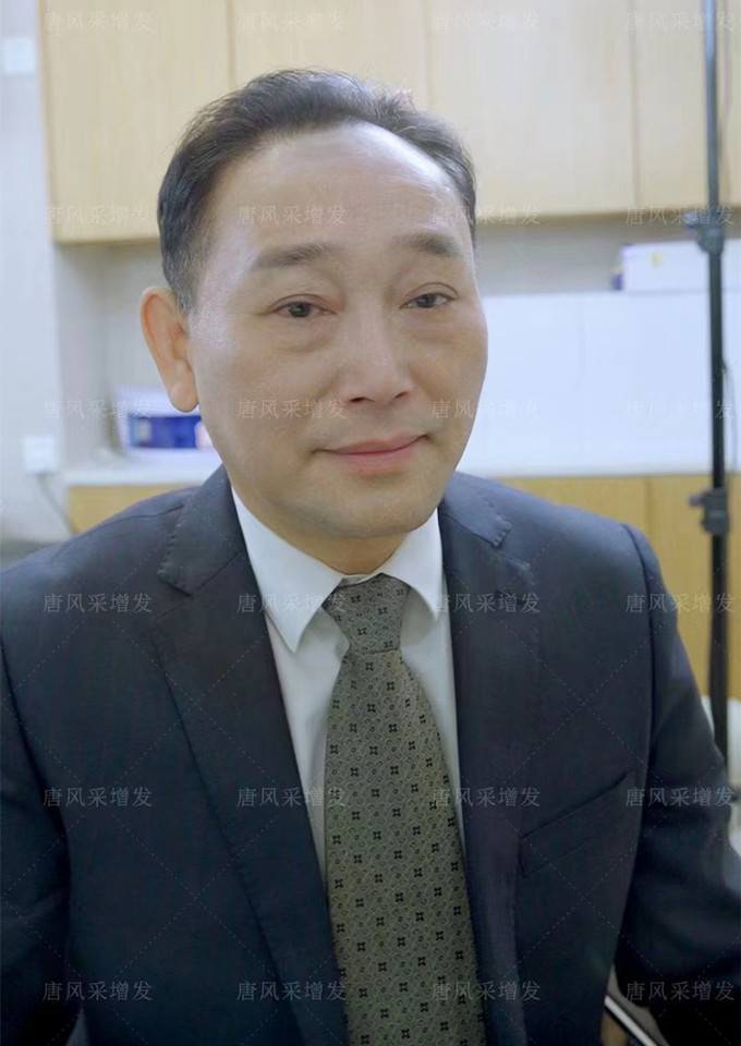 無錫男士假發 \