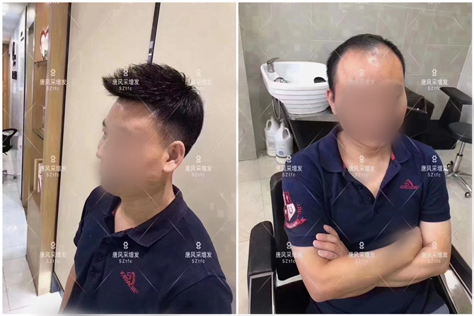 泉州男士假發 \