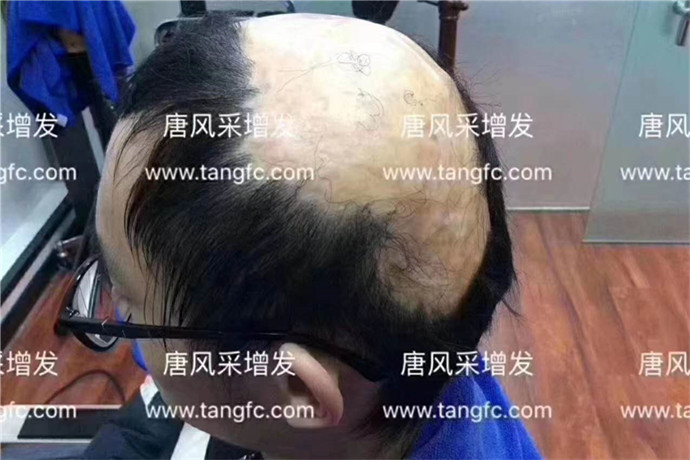 石家莊男士假發哪家強 \