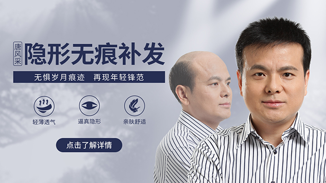 石家莊男士假發哪家強 \