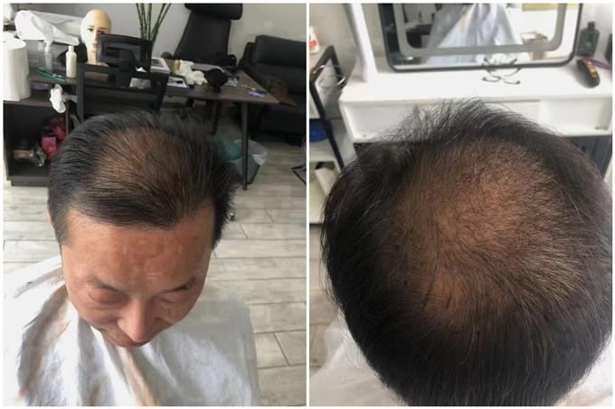南通假發 \