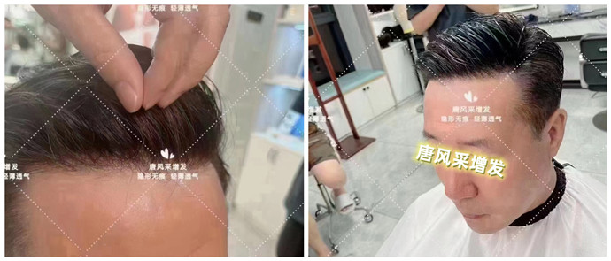 郴州假發片 \