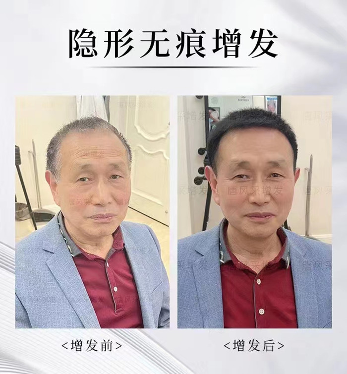 東莞中老年選假發 \