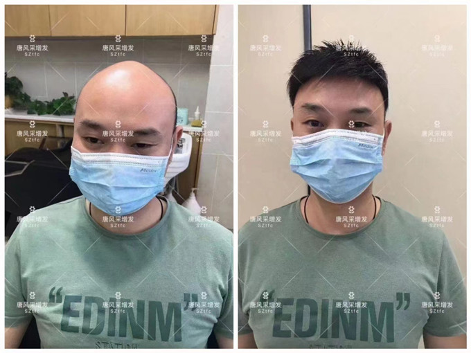 紹興高檔假發 \