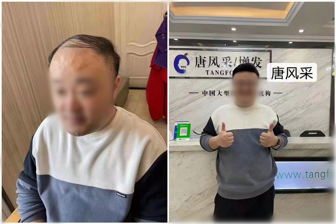 柳州假發攻略 \