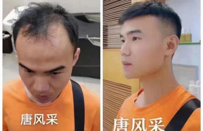 補發假發 \