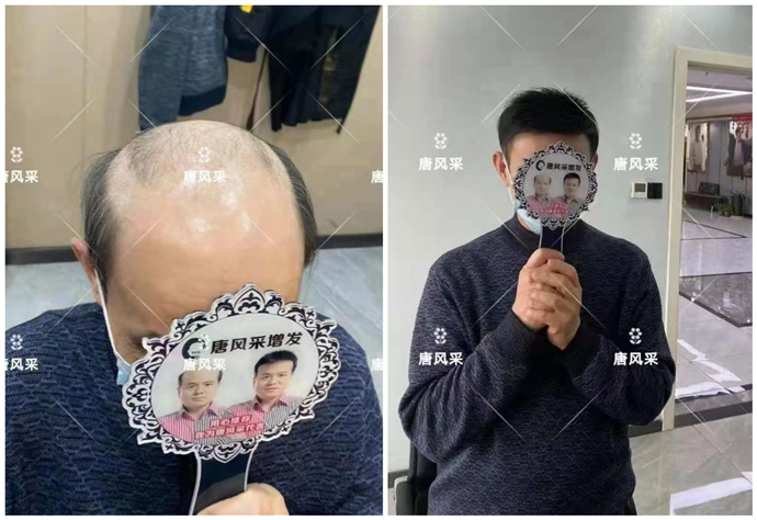 蘇州男士假發銷售量 \