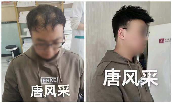 蘇州男士假發銷售量 \