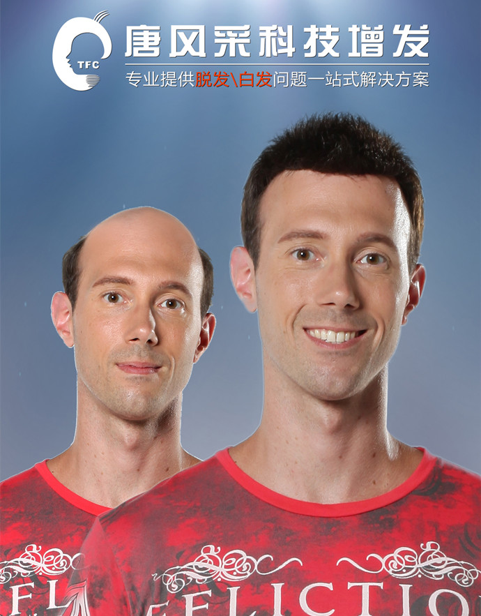蘇州男士假發銷售量 \
