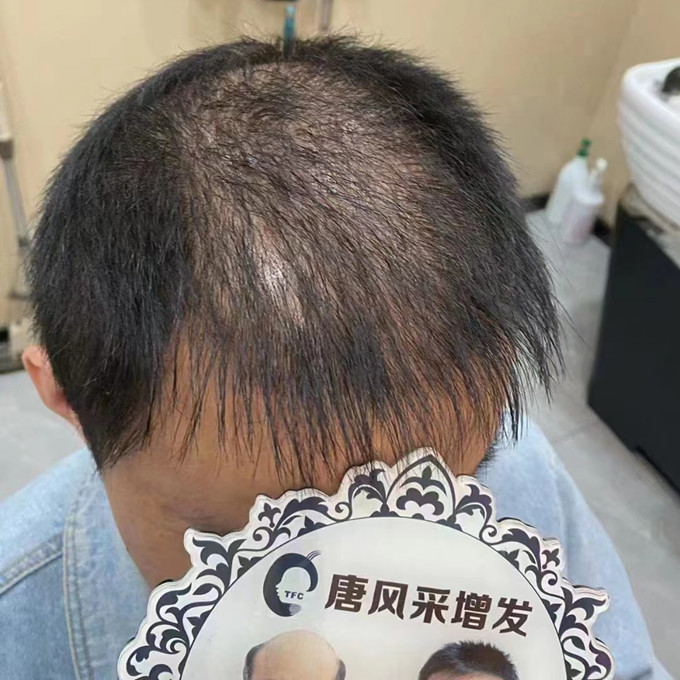 長沙哪里有男假發賣 \