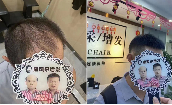 天津定制假發哪家好 \
