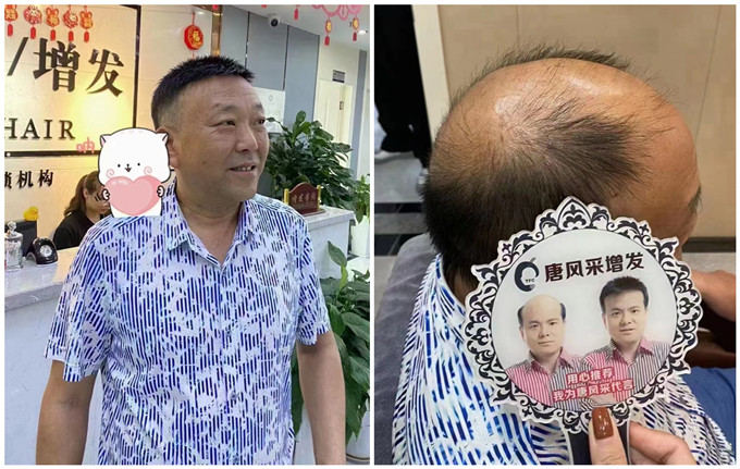 長沙假發實體店 \
