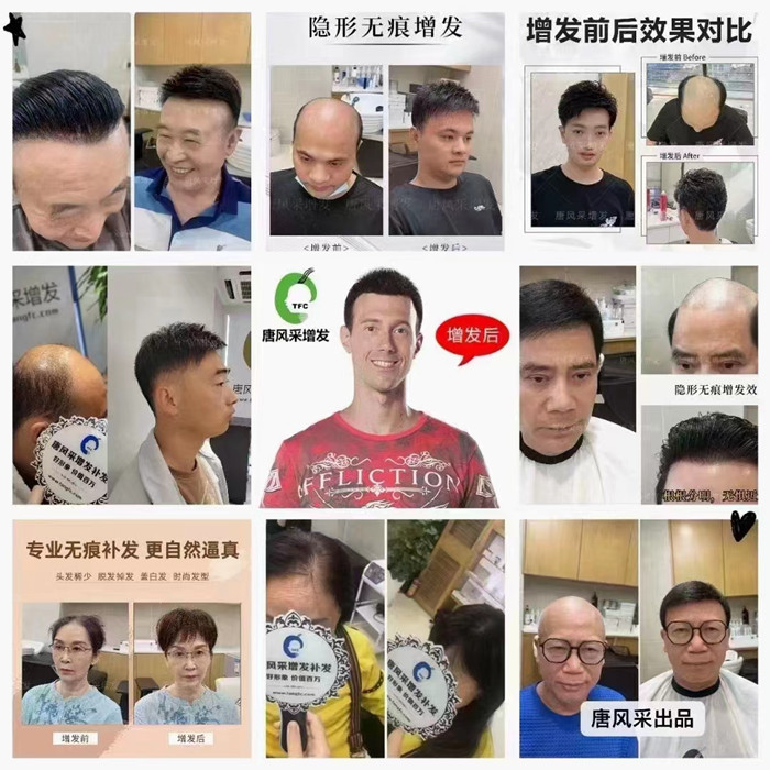 廣州男士假發 \