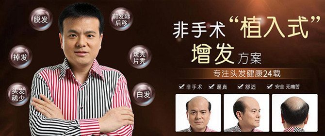 廣州男士假發 \