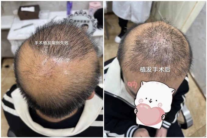 濟南假發實體店 \