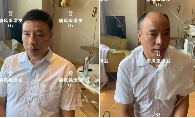 濟南假發實體店 \