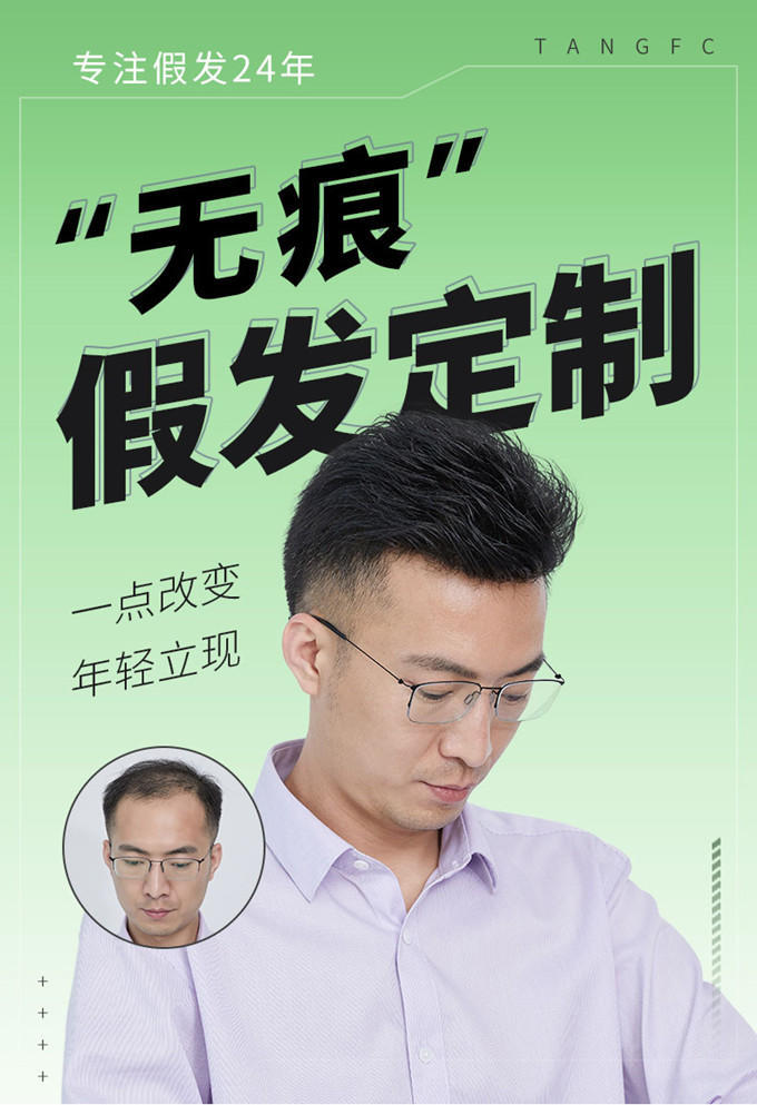 變高的發際線 \