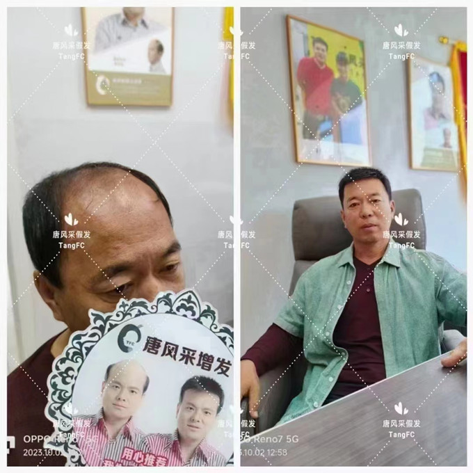漳州假發實體店 \