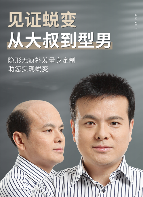 佛山男士假發店哪里有 \