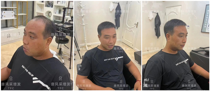 佛山男士假發店哪里有 \