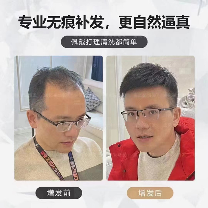 佛山男士假發店哪里有 \