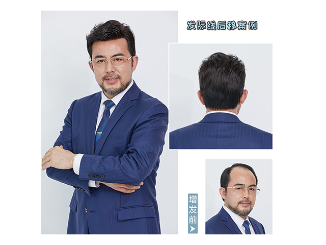 東莞什么地方有假發實體店 \