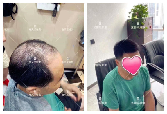 東莞什么地方有假發實體店 \